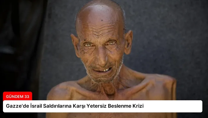 Gazze’de İsrail Saldırılarına Karşı Yetersiz Beslenme Krizi